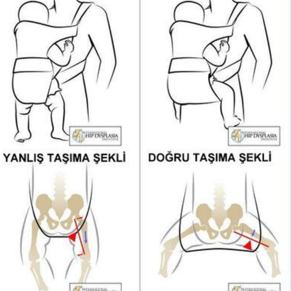 Ergonomik Kanguru Kullanımı